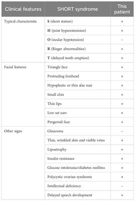 Atypical diabetes arising from SHORT syndrome: a case report